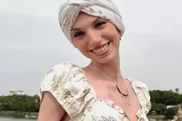 விசித்திரமான எலும்பு நோயால் பாதிக்கப்பட்ட இளம்பெண்