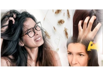 பேன் தொல்லை பாடாய்படுத்துகிறதா? இதோ வீட்டு வைத்தியம்