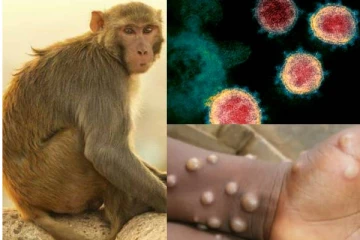 பரவிவரும் குரங்கு அம்மை நோய்: பாதிக்கப்பட்டவர்களின் எண்ணிக்கை 780ஆக அதிகரிப்பு