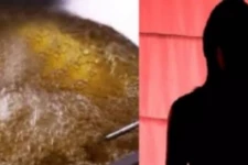 சண்டையில் விபரீதம்- தூங்கிய கணவன் முகத்தில் கொதிக்கும் எண்ணெய்யை ஊற்றிய மனைவி