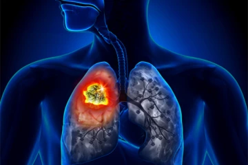 இலங்கையில் நாளாந்தம் அதிகரிக்கும் உயிரிழப்புக்கள்: விடுக்கப்பட்டுள்ள எச்சரிக்கை