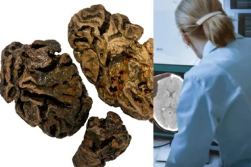 மரணத்திற்கு பின் இது நடக்குமா? 12,000 ஆண்டுகள் பழமையான மூளையால் பிரித்தானிய விஞ்ஞானிகள் குழப்பம்