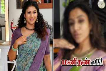 ஆல்யாவிற்கு என்னாச்சு? முகமெல்லாம் சுருங்கிய நிலையில் வெளியான புகைப்படம்