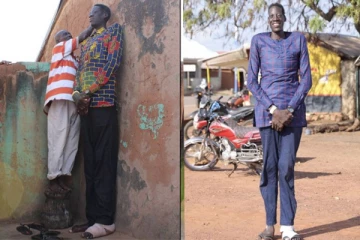 வளர்ந்துக் கொண்டே செல்லும் அதிசய மனிதர்: வெளிவரும் விநோத பிண்ணனி