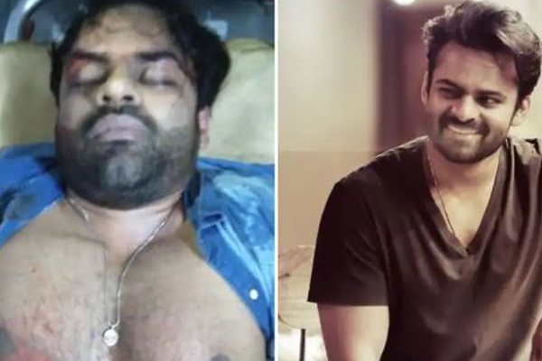கோர விபத்தில் சிக்கிய பிரபல நடிகர் – சுயநினைவை இழந்ததால் ரசிகர்கள் அதிர்ச்சி: பதைபதைக்கும் காட்சி | Accident Telengana Actor In Coma Stage