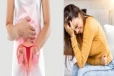 பெண்களே அவசியம் தெரிஞ்சிக்கோங்க.., கர்ப்பப்பை வாய் புற்றுநோயை தடுப்பதற்கான 5 வழிகள்