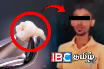 பல் பிடுங்கிய நபருக்கு ஏற்பட்ட துயரம்