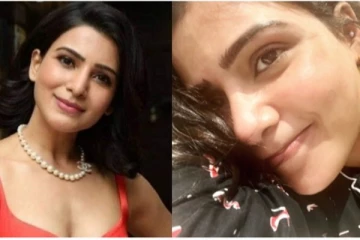 ரத்த காயங்களுடன் சமந்தா; பரவும் ஃபோட்டோ - ரசிகர்கள் அதிர்ச்சி