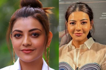 பிளாஸ்டிக் சர்ஜரியா? முகம் வீங்கி அடையாளம் தெரியாமல் மாறிய காஜல் அகர்வால்