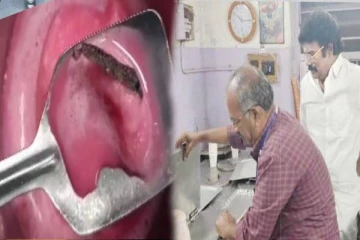 ஐஸ்கிரீமுக்குள் பாதியாக செத்து கிடந்த பல்லி - பதறிப்போன வாடிக்கையாளர்!