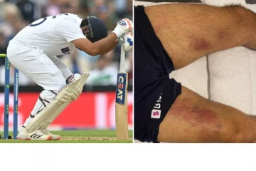 வலியை மறைத்து சதம் அடித்த ரோகித்! வெளியான புகைப்படம்: கடும் வேதனையில் ரசிகர்கள்