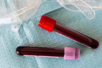 கருச்சிதைவு ஏற்பட்ட பெண்ணின் உடலில் ஆண் குரோமோசோம்கள்: வியப்பில் மருத்துவர்கள்