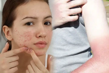 அடிக்குற வெயிலுக்கு முகம் கருப்பா இருக்கா? இத மட்டும் Try பண்ணுங்க போதும்!