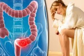 மூல நோய் யாருக்கு எல்லாம் ஏற்படும்? எப்படி தடுக்கலாம்?