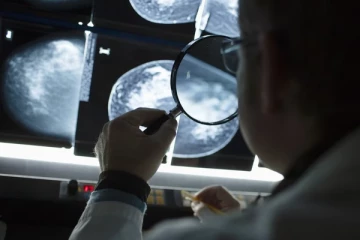 இளம் வயதினரிடையே அதிகரிக்கும் புற்றுநோய்: எச்சரிக்கும் சுவிஸ் மருத்துவர்