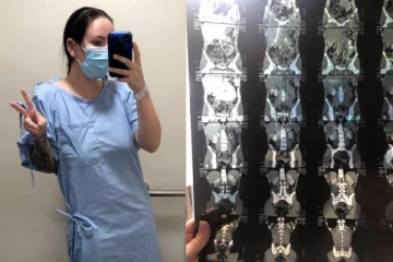 இரண்டு பெண்ணுறுப்பு... 16 வயதில் தெரிந்த உண்மை! தைரியமாக பகிர்ந்த இளம் பெண்