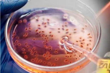 මාරාන්තික භයානක උණක් ගැන වෛද්‍යවරුන්ගෙන් විශේෂ දැනුම්දීමක්.....(VIDEO)