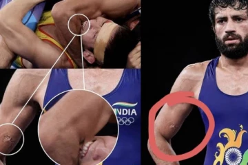 ஒலிம்பிக் மல்யுத்த போட்டியில் இந்திய வீரரை கடித்த கஜகஸ்தான் வீரர் மீது நடவடிக்கை எடுக்கப்படாது! UWW சொன்ன காரணம்