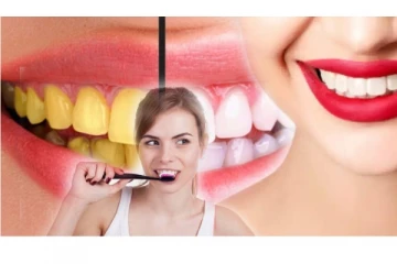 பற்களின் மஞ்சள் கறை உங்களை சிரமப்பட வைக்கிறதா? கவலை வேண்டாம்... வெள்ளையாக்க இதோ இயற்கை டிப்ஸ்