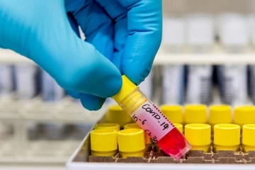 கந்தளாயில் வங்கி ஊழியர்கள் உட்பட 9 பேருக்கு கோவிட் தொற்று உறுதி