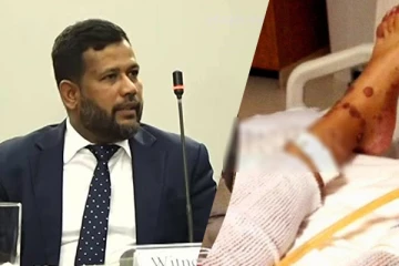 ரிஷாத் பதியுதீனின் வீட்டில் பணியாற்றிய சிறுமி தீக்காயங்களுடன் வைத்தியசாலையில் அனுமதி!