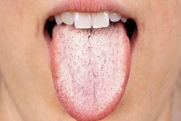 நாக்கில் இந்த அறிகுறிகள் இருக்கா? அப்போ இந்த ஆபத்து உறுதி | What Do Different Tongue Textures Mean