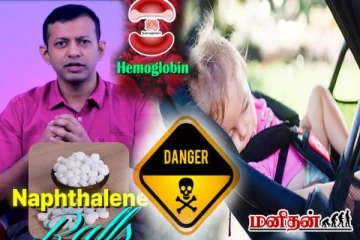 குழந்தைகளின் உயிரை காவு வாங்க்கூடிய நெப்தலின் உருண்டைகள்! எச்சரிக்கும் மருத்துவர்