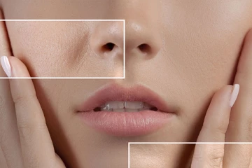 உங்கள் முகம் மேடு பள்ளமா அசிங்கமா இருக்குதா? இதனை போக்க இதோ சூப்பரான டிப்ஸ்