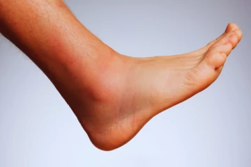 வாய்த்தர்க்கத்தில் நண்பரின் பாதத்தை வெட்டித் துண்டாடிய நபர்