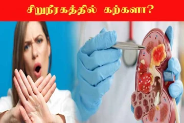 Kidney Stone: மறந்தும் கூட இந்த 5 உணவுகளை சாப்பிட வேண்டாம்