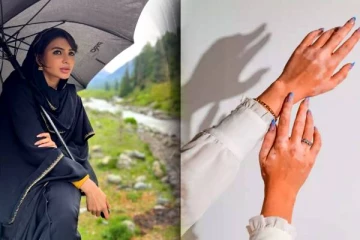 சமந்தா உட்பட பல பிரபலங்களை தாக்கிய ஆட்டோ இம்யூன் கோளாறு பற்றி தெரியுமா?