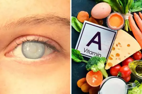 உடலுக்கு வைட்டமின்-ஏ கட்டாயம் தேவை: ஏன் தெரியுமா? | Vitamin A Is Essential For The Body Do Know Why