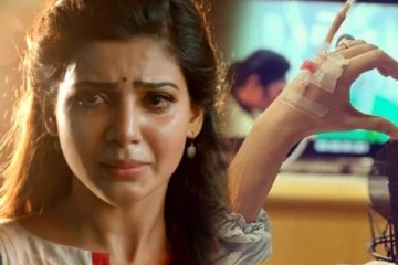 விவாகரத்துக்கு பின் சமந்தா உடம்பில் இப்படியொரு நோயா.. அதிர்ச்சியளிக்கும் புகைப்படம்