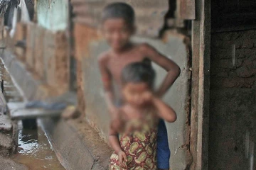 3000 மேற்பட்ட சிறுவர்கள் போசாக்கின்மையால் பாதிப்பு