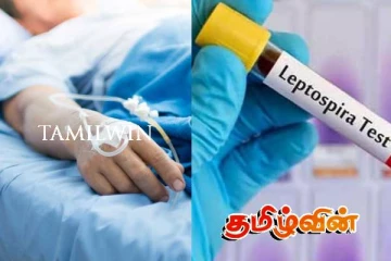 யாழில் எலிக்காய்ச்சல் நோயாளிகளின் எண்ணிக்கை சடுதியாக அதிகரிப்பு