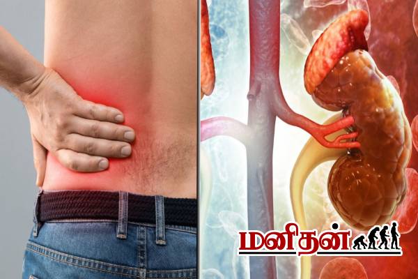 கிட்னியை சுற்றி பாதுகாப்பு வளையம் போடும் வாழைத்தண்டு