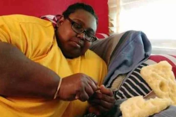 20 ஆண்டுகளாக மொத்தைகளை உண்ணும் அமெரிக்க பெண்!