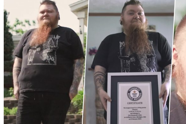 கின்னஸ் சாதனைக்காக தாடி வளர்த்த பெண்! | The Woman Who Grew A Beard Guinness Record