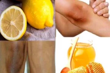 கை கால்களில் ஏற்படும் கருமையை போக்க எளிய இயற்கை மருத்துவம்