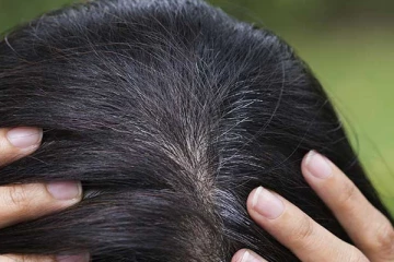 வெள்ளை முடி வேகமா மறையணுமா? இந்த ஒரு டிப்ஸை பின்பற்றி வந்தாலே போதும்