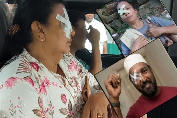 ஷிரந்தியால் இலங்கையில் ட்ரெண்டான புதிய வகை கண் நோய்