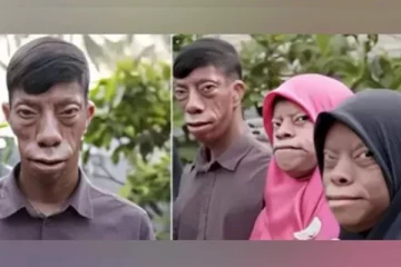 பகலில் சாதாரண மனிதன், இரவில் பல்லி முகம் கொண்ட மனிதன்! இந்தோனேசியாவில் ஆச்சரியம்