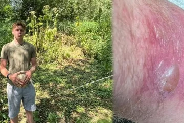 காலில் பட்ட விஷச் செடியால் பிரித்தானியருக்கு நேர்ந்த துயரம்: ஒரு எச்சரிக்கை செய்தி