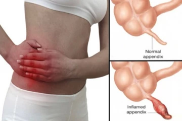 வயிற்றில் இந்த பகுதியில் அதிக வலி ஏற்படுகின்றதா? உயிர் போகும் அபாயம் ஜாக்கிரதை