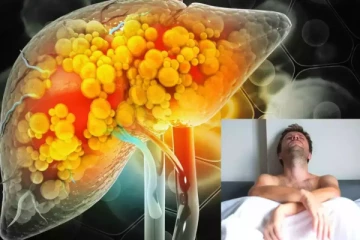 மது, உணவு மட்டுமில்லை இந்த பழக்கமும் கல்லீரலை பாதிக்குமா?