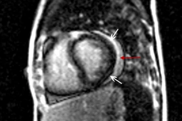 தடுப்பூசி போட்டுக்கொண்ட இளைஞர்களுக்கு ஏற்படும் புதிய சிக்கல்! ஆய்வில் தெரியவந்த பகீர் தகவல்