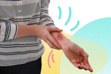 පිළිස්සුම් තුවාල වලට අයිස් තැබීම සුදුසුද? නැද්ද?