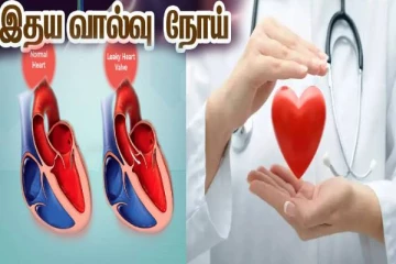 இதய வால்வு நோய்கள் பற்றி உங்களுக்கு தெரியுமா? இந்த அறிகுறிகள் இருந்தால் ஜாக்கிரதை!