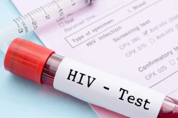 வெளிநாட்டில் இருந்து வவுனியா வந்த இருவருக்கு எயிட்ஸ்