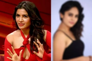 சமந்தாவை போல் அரியவகை நோயால் பாதிக்கப்பட்ட 33 வயது நடிகை.. யார் தெரியுமா